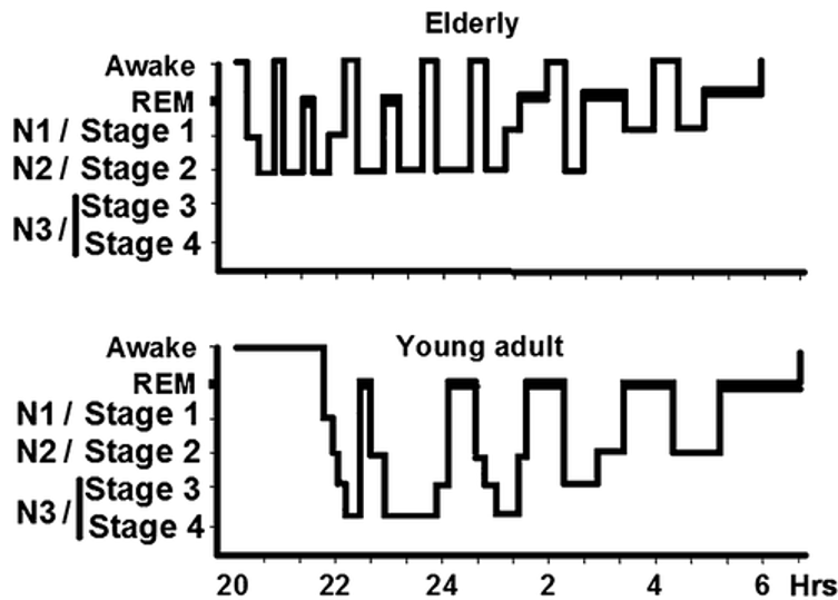 年輕人與老年人睡眠圖比較
